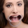 Расширитель рта Cheek Retractor Dental Mouth Gag
